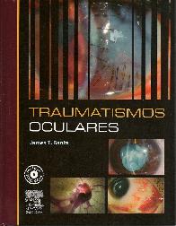 Traumatismos Oculares