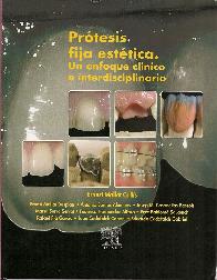 Protesis fija estetica