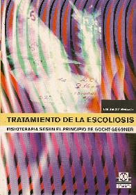 Tratamiento de la Escoliosis