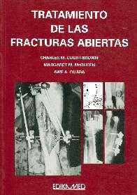 Tratamiento de las fracturas abiertas