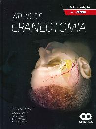 Atlas de craneotoma