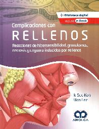 Complicaciones con rellenos