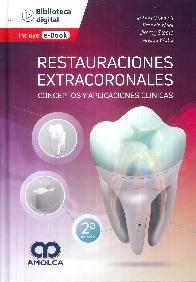 Restauraciones extracoronales. Conceptos y aplicaciones clnicas