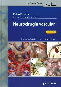 Neurociruga vascular