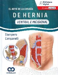 El arte de la Ciruga de la Hernia - Ventral e Incisional