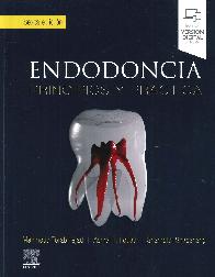 Endodoncia. Principios y prctica