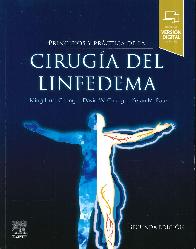 Principios y prctica de la ciruga del linfedema