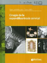 Ciruga de la Espondiloartrosis Cervical