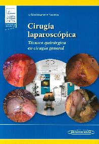 Ciruga laparoscpica Tcnica quirrgica en ciruga general