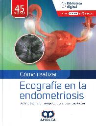 Cmo realizar Ecografa en la endometriosis