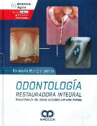 Odontologa restauradora integral. Rehabilitacin del diente endodnticamente tratado