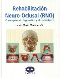 Rehabilitacin Neuro-Oclusal (RNO)