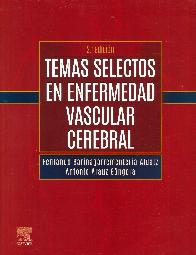Temas selectos en enfermedad vascular cerebral