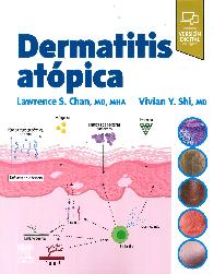 Dermatitis atpica
