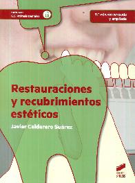 Restauraciones y recubrimientos estticos