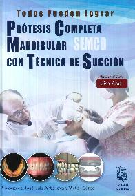 Prtesis completa mandibular con tcnica de succin