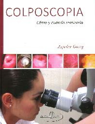 Colposcopia