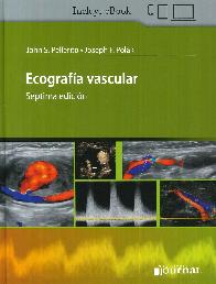 Ecografia Vascular