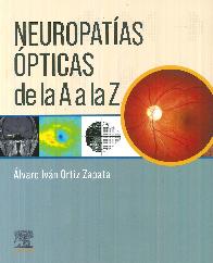 Neuropatas pticas de la A a la Z