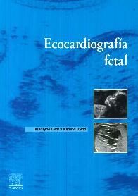Ecocardiografa fetal