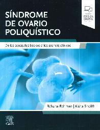 Sndrome de ovario poliqustico