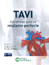 TAVI Estrategias para un implante perfecto