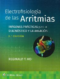 Electrofisiologa de las Arritmias. Imgenes prcticas para el diagnstico y la ablacin