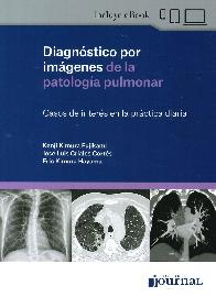Diagnstico por imgenes de la patologa pulmonar
