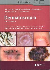 Dermatoscopia