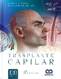 Trasplante capilar