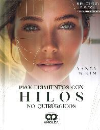 Procedimientos con hilos no quirrgicos.