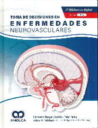Toma de Decisiones en Enfermedades Neurovasculares