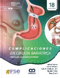 Complicaciones en ciruga baratrica