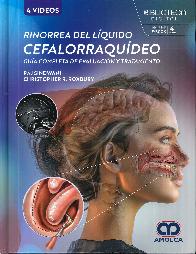 Rinorrea del lquido cefalorraqudeo. Gua completa de evaluacin y tratamiento