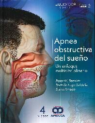 Apnea obstructiva del sueo. Un enfoque multidisciplinario