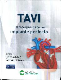 TAVI Estrategias para un implante perfecto