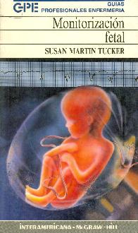 Monitorizacion Fetal