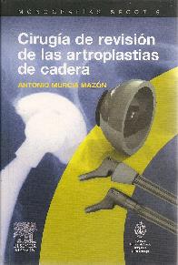 Ciruga de revisin de las artroplastias de cadera