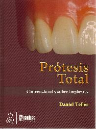 Prtesis Total