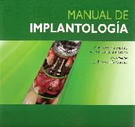 Manual de Implantologa