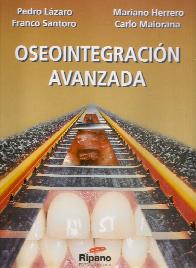 Oseointegracin Avanzada