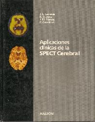 Aplicaciones clinicas de la SPECTcerebral