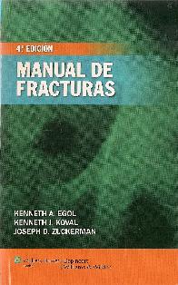 Manual de Fracturas