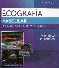 Ecografa vascular