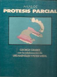 Atlas de protesis parcial