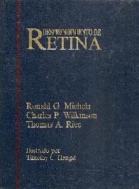 Desprendimiento de retina