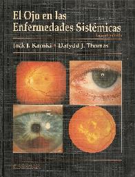 Ojo en las enfermedades sistemicas