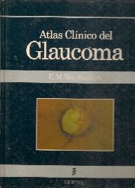 Atlas clinico del glaucoma