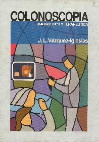 Colonoscopia Diagnostica y terapeutica