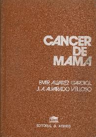 Cancer de mama